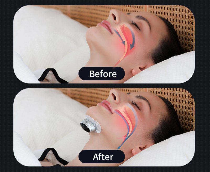 Advanced Sleep Apnea Treatment Device Pro