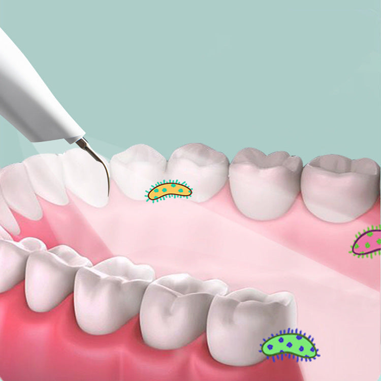 Advanced Sonic Tooth Cleaner For Plaque Removal