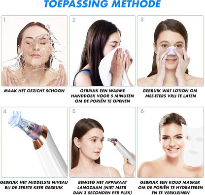 Deep Pore Cleaning Facial Blackhead Remover