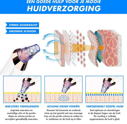 Deep Pore Cleaning Facial Blackhead Remover