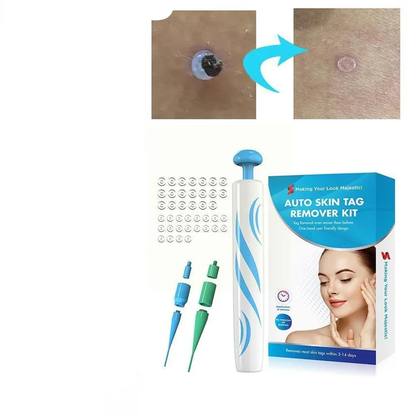 Fast Effective Mole and Tag Remover Kit