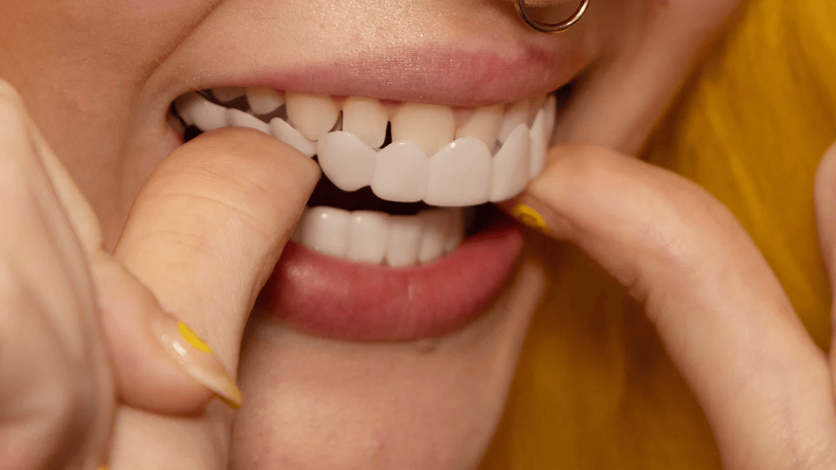 Simple Clip On Teeth Veneers Kit