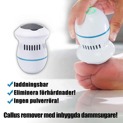 Effective Foot Callus Remover