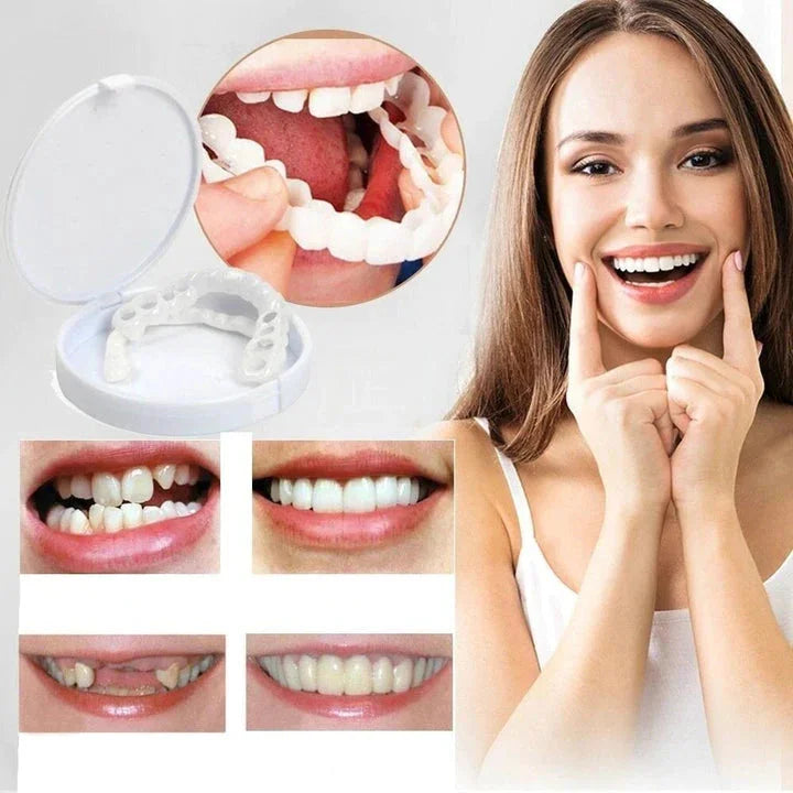 Simple At Home Teeth Veneers Kit