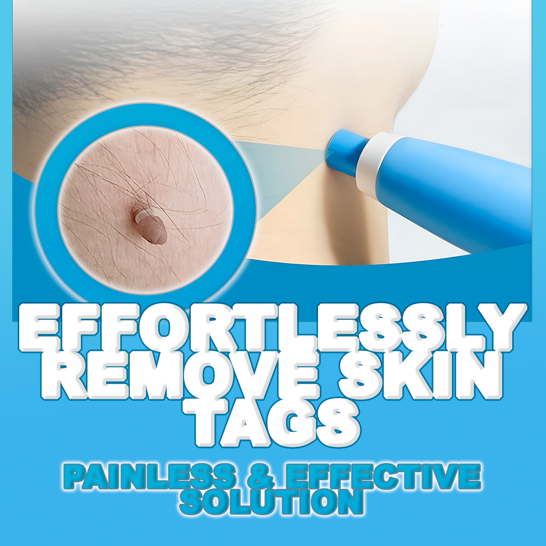 Easy Skin Tag Removal Tool