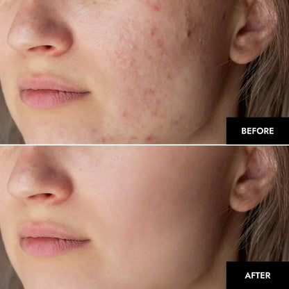Advanced Collagen Face Mask: Deep Hydrating Anti Aging