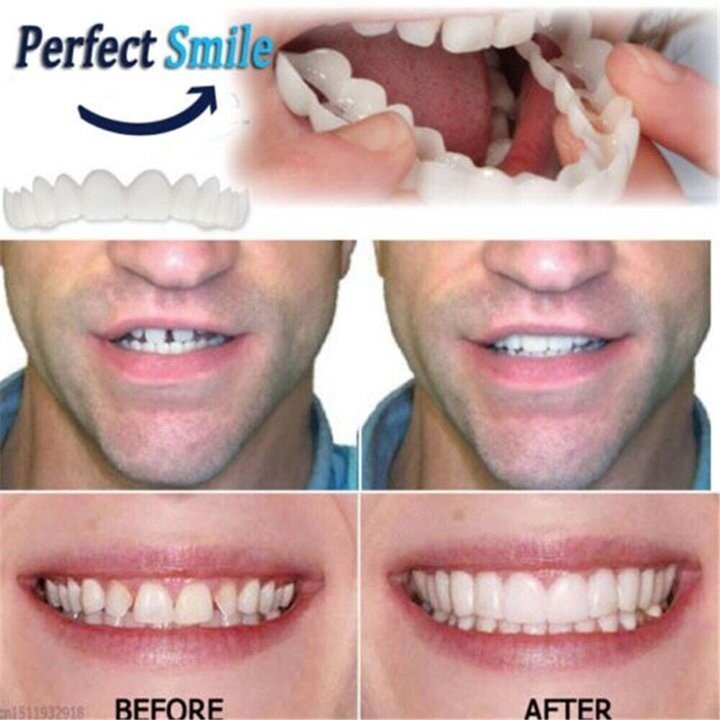 Custom Fit Snap On Dental Plates