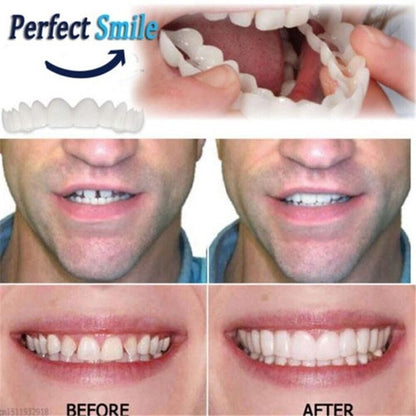 Custom Fit Snap On Dental Plates