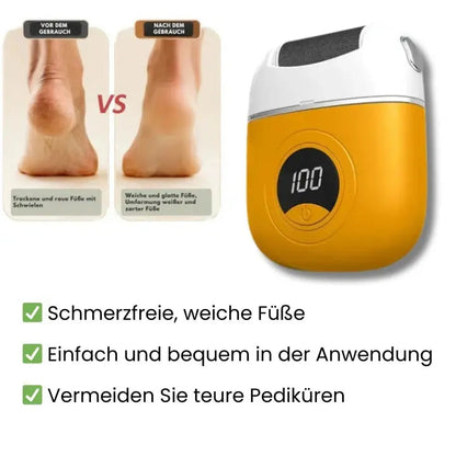 Fast Foot Callus Shaver - Luxicro
