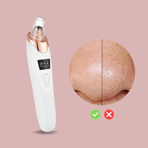 Easy Blackhead Cleaner Facial Vacuum Tool