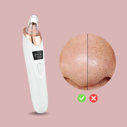 Easy Blackhead Cleaner Facial Vacuum Tool
