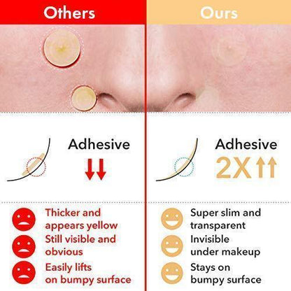 Quick Fix Acne and Spot Treatment Patches