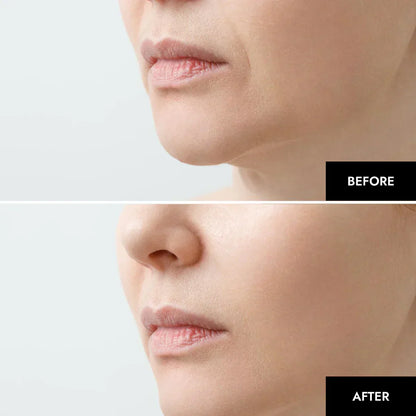 Advanced Collagen Face Mask: Deep Hydrating Anti Aging