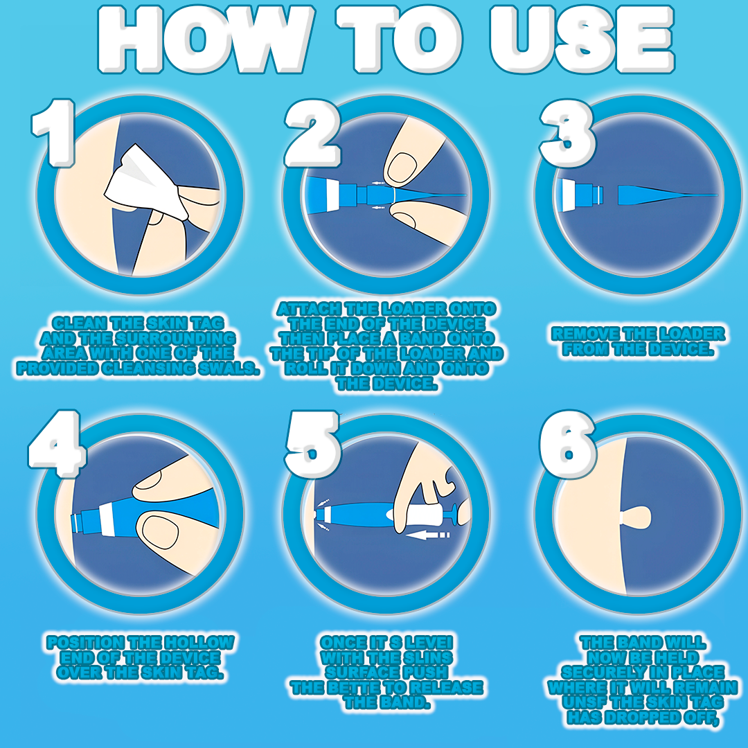 Easy Skin Tag Removal Tool
