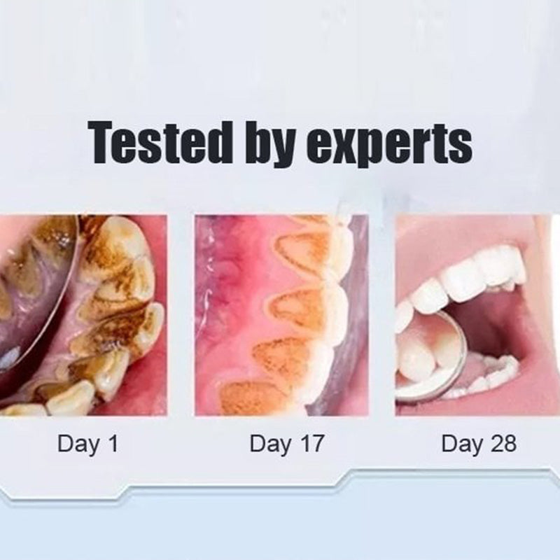 Advanced Whitening Probiotic Toothpaste