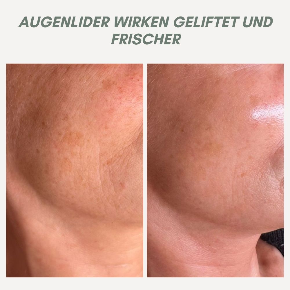 Anti Aging Facial Serum for Smoother Skin