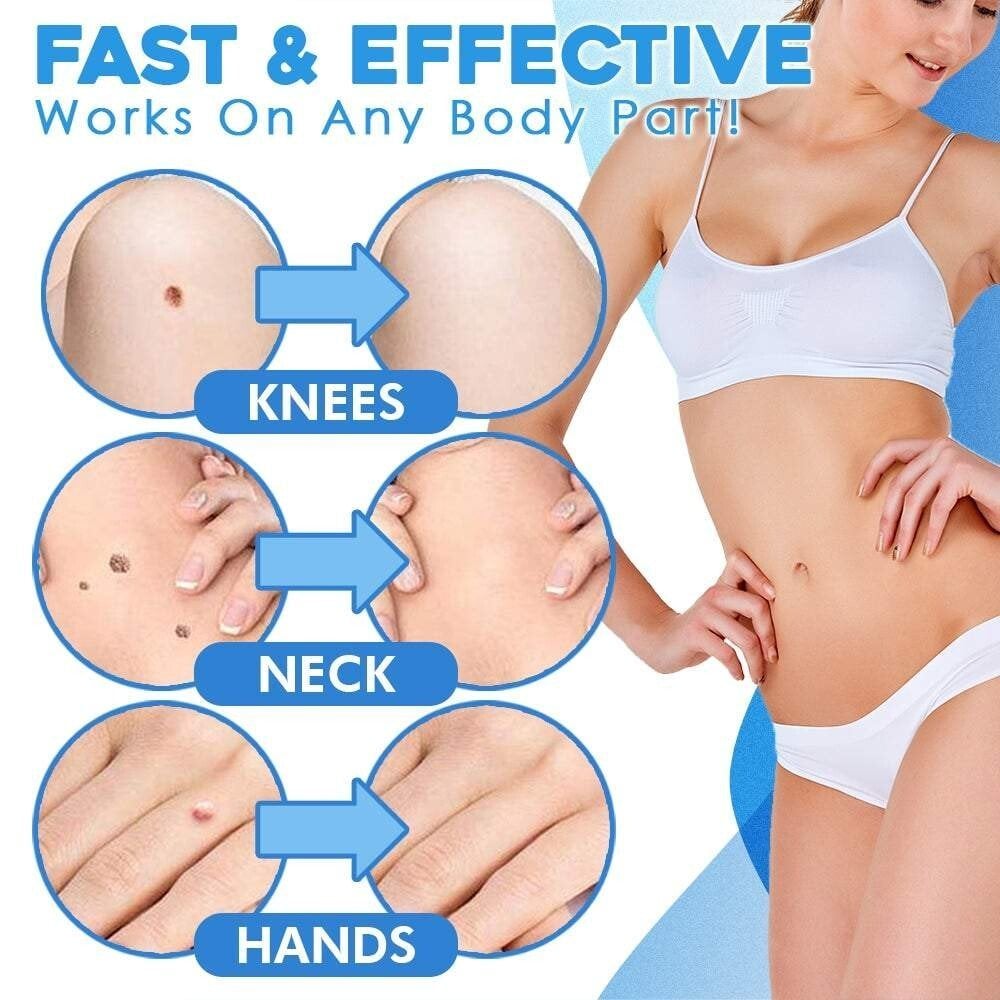 Easy Hair Removal at Home in 10 Days