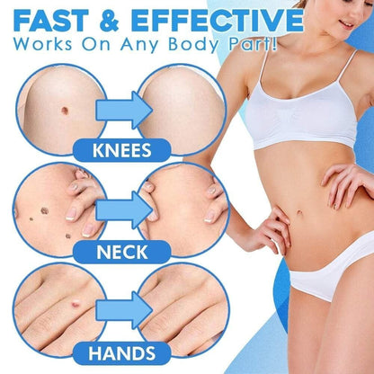 Easy Hair Removal at Home in 10 Days