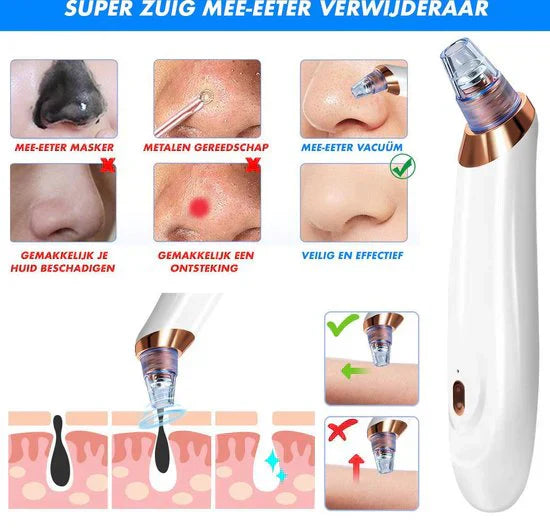 Deep Pore Cleaning Facial Blackhead Remover