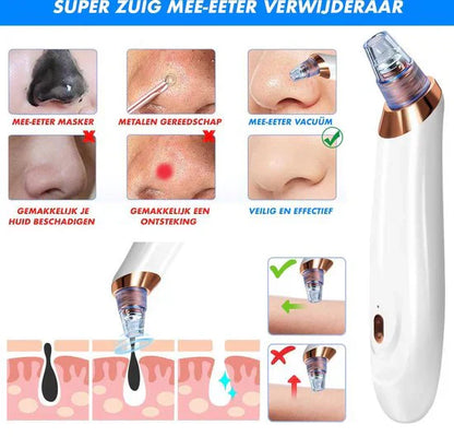 Deep Pore Cleaning Facial Blackhead Remover