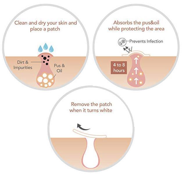 Quick Fix Acne and Spot Treatment Patches