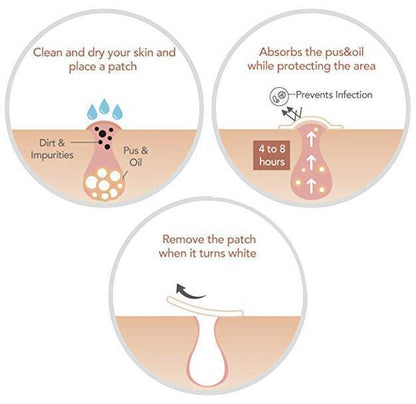 Quick Fix Acne and Spot Treatment Patches