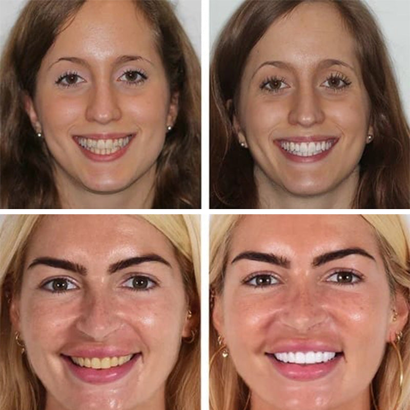 Advanced Whitening Probiotic Toothpaste