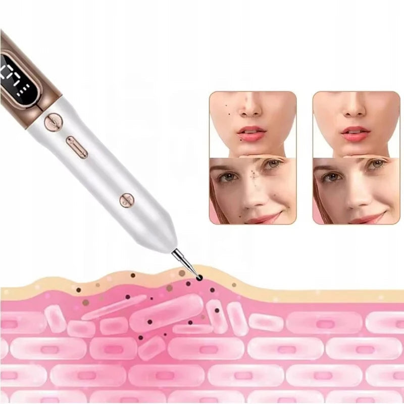 Portable Skin Tag Remover Pen For Home Use