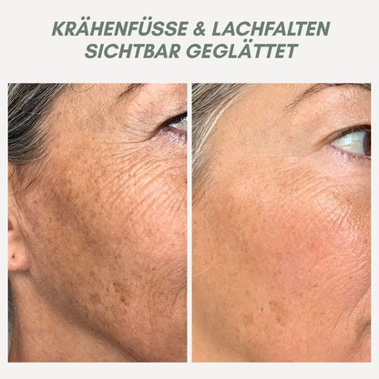 Anti Aging Facial Serum for Smoother Skin