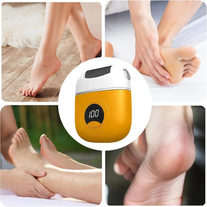 Fast Foot Callus Remover Kit