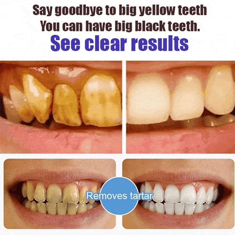 Advanced Whitening Probiotic Toothpaste