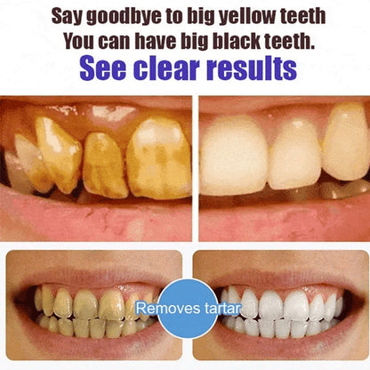 Advanced Whitening Probiotic Toothpaste