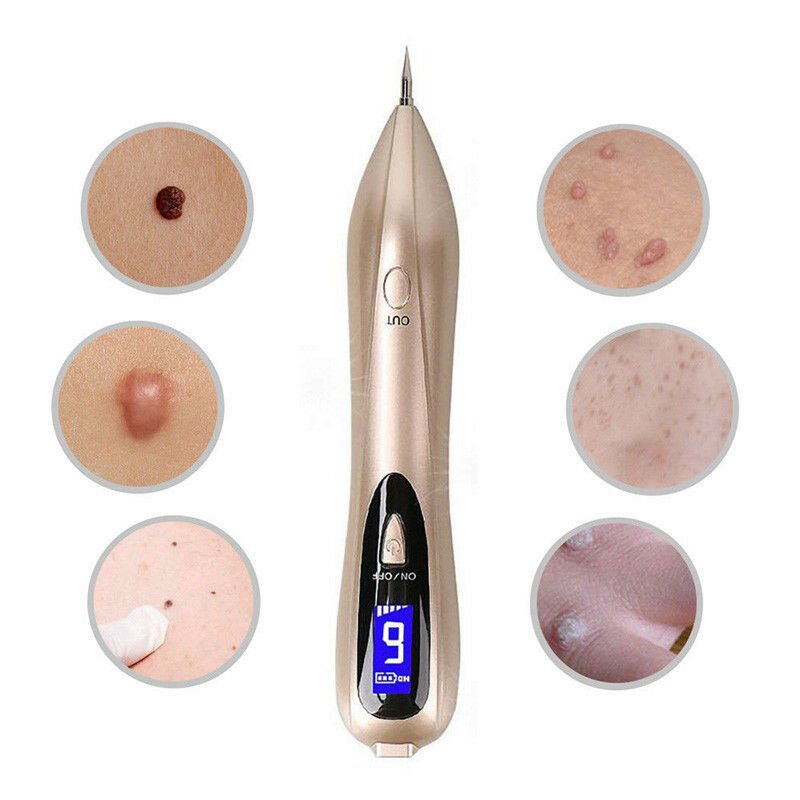 Portable Blemish Remover Pen | Rechargeable Acne Device - Luxicro