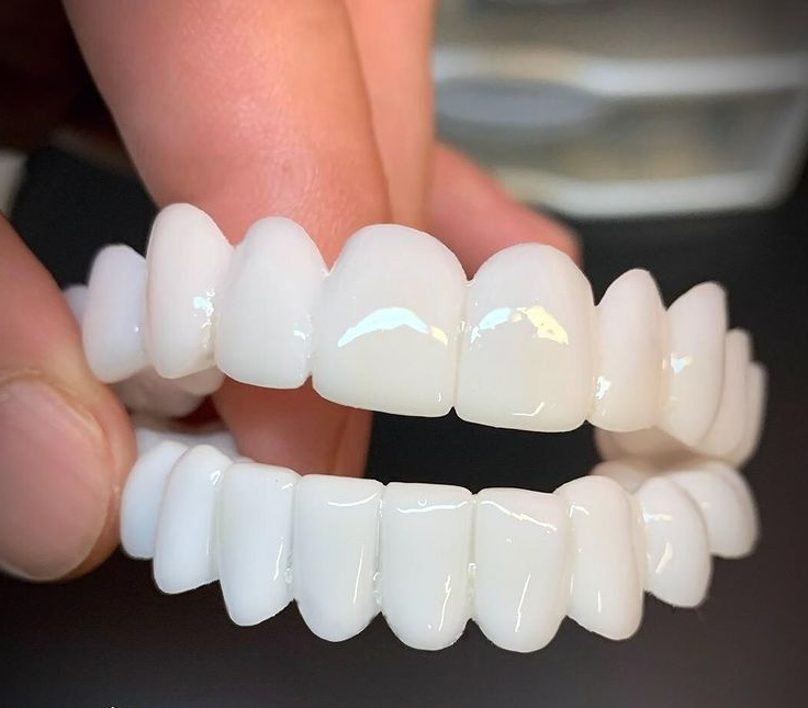 Comfort Fit Dental Aligner - Removable White Teeth Straightener - Luxicro