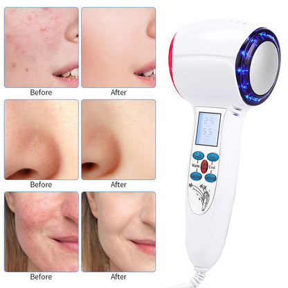 Advanced Home Facial Cryo Treatment Machine