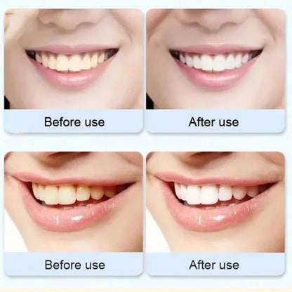Advanced Whitening Probiotic Toothpaste