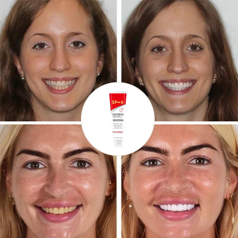 Advanced Whitening Probiotic Toothpaste