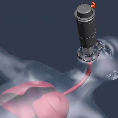 Emergency Choking Relief Device