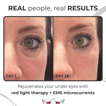 Anti Aging Eye Mask with Red Light Therapy