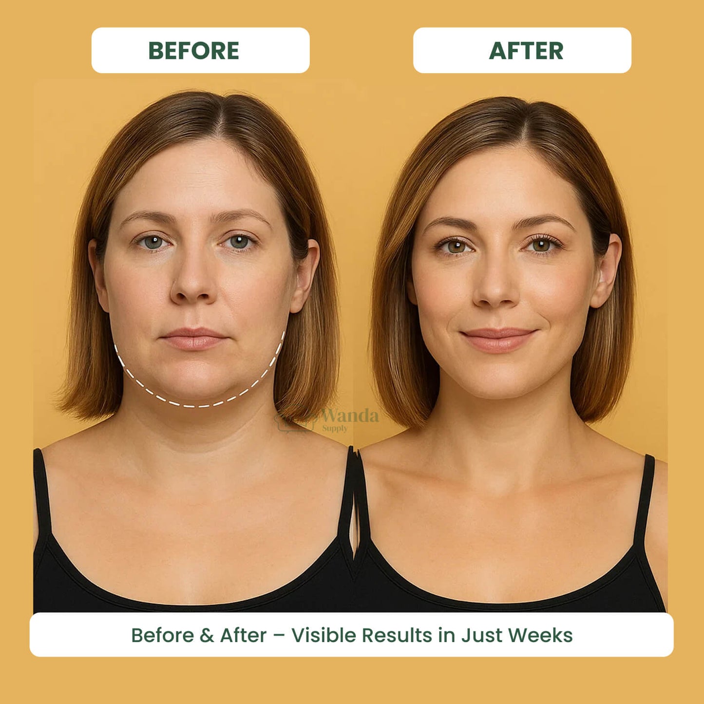 Slimming Face Massager with LED Light Therapy
