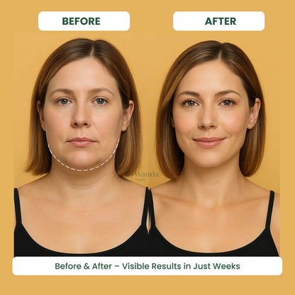 Slimming Face Massager with LED Light Therapy