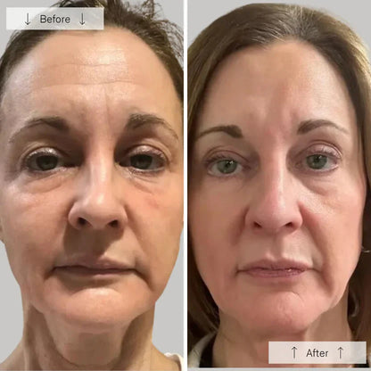 Advanced LED Face Mask for Skin Rejuvenation Therapy