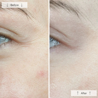 Advanced LED Face Mask for Skin Rejuvenation Therapy