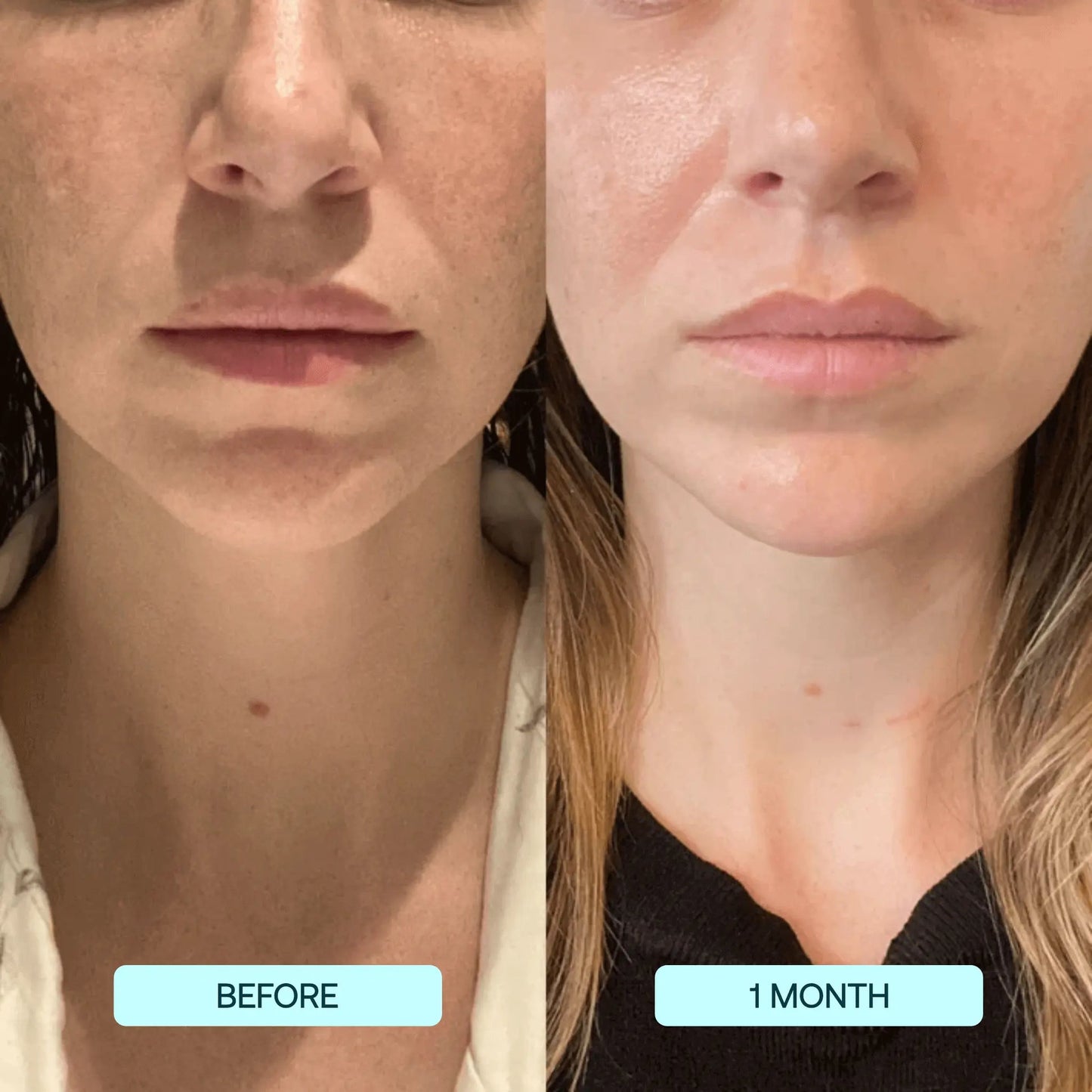 Advanced Collagen Face Mask: Deep Hydrating Anti Aging