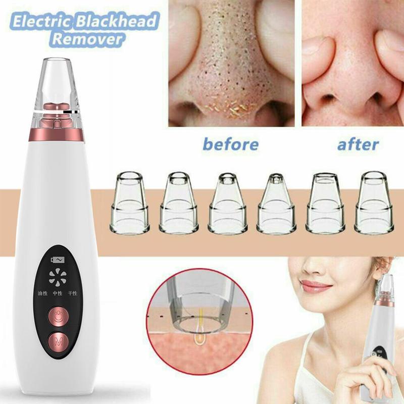 Deep Cleansing Electric Blackhead Remover Tool