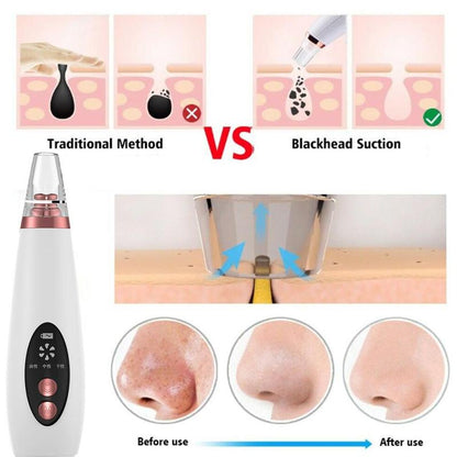 Deep Cleansing Electric Blackhead Remover Tool