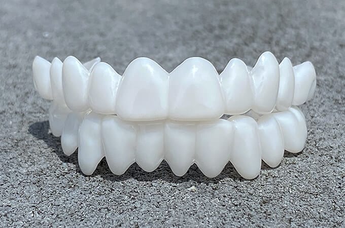 Custom Fit Dental Veneers for Perfect Smiles