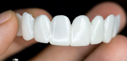 Custom Fit Dental Veneers for Perfect Smiles
