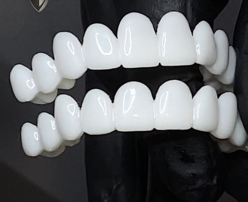 Custom Fit Dental Veneers for Perfect Smiles