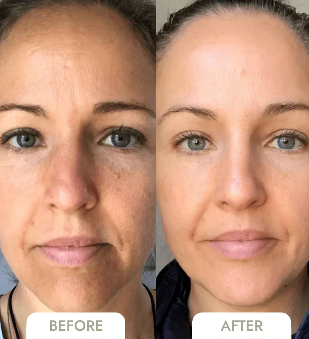 Advanced Collagen Face Mask: Deep Hydrating Anti Aging
